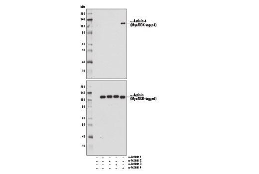 Western Blotting Image 2: α-Actinin 4 (D7U5A) Rabbit mAb 