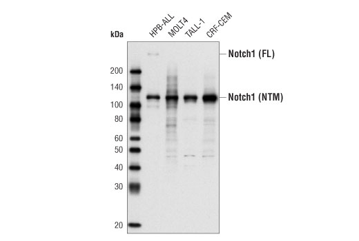 Western Blotting Image 1: Notch1 (D1E11) XP® Rabbit mAb
