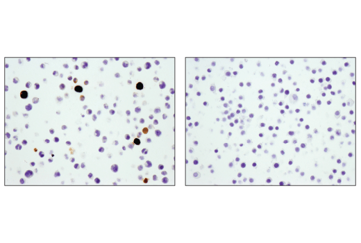 Immunohistochemistry Image 1: S100A9 (D3U8M) Rabbit mAb