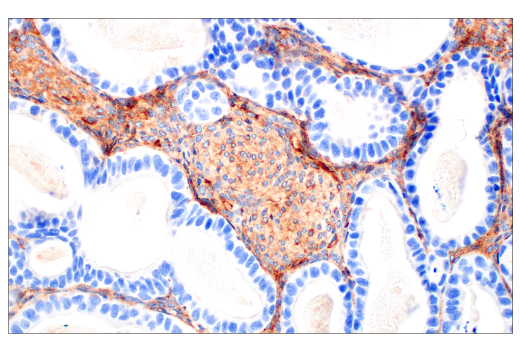 Immunohistochemistry Image 1: BST2 (E4N3W) XP<sup>®</sup> Rabbit mAb