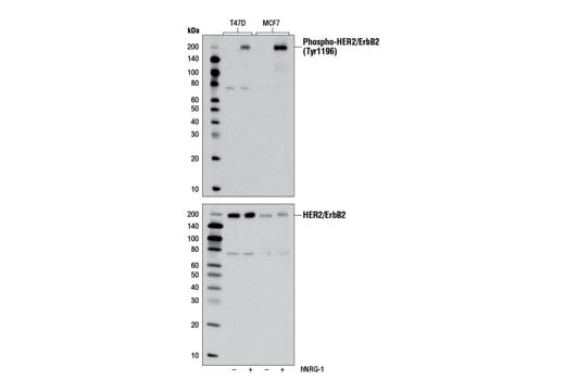 Western Blotting Image 1: Phospho-HER2/ErbB2 (Tyr1196) (D66B7) Rabbit mAb