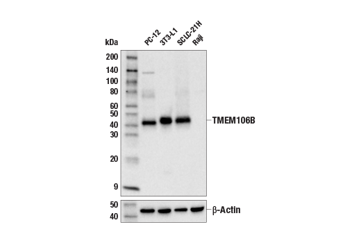 Western Blotting Image 1: TMEM106B (E7H7Z) Rabbit mAb
