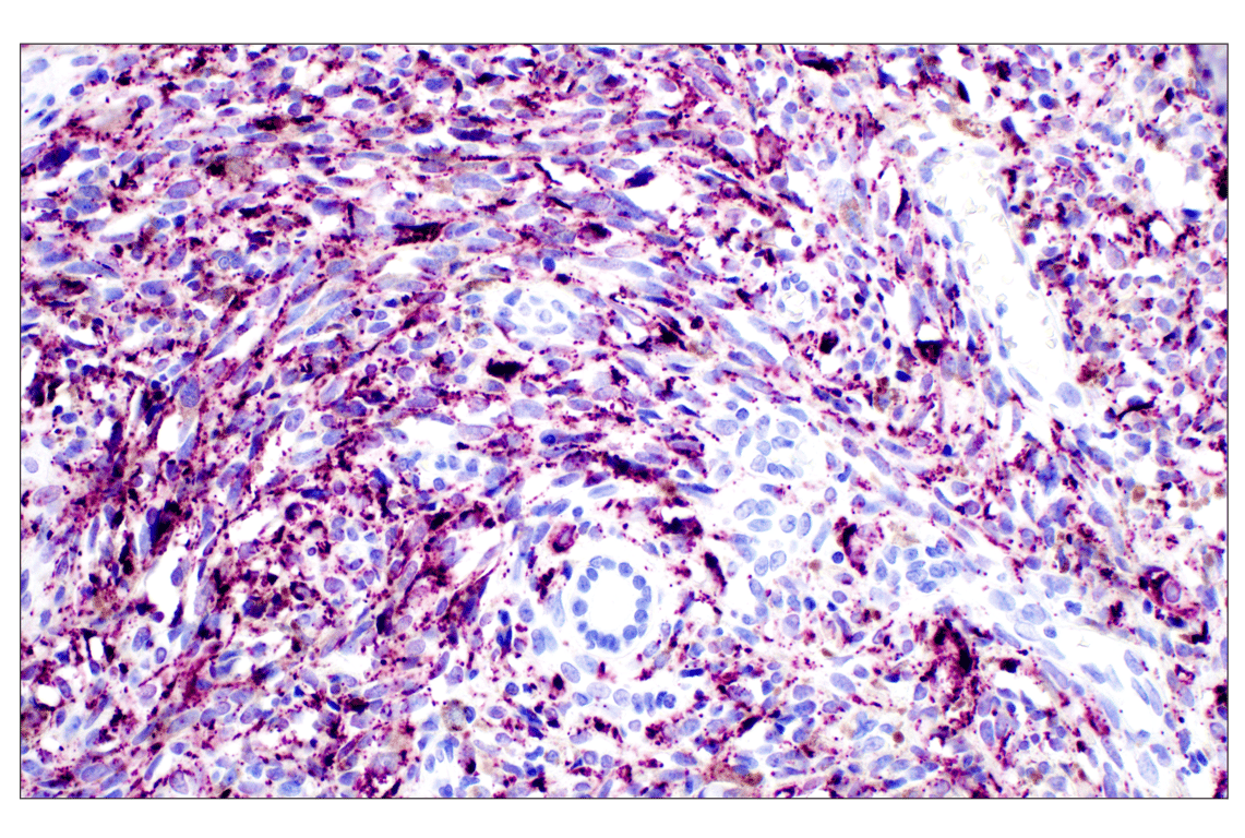 Immunohistochemistry Image 8: Perilipin-2 (E6G6M) Rabbit mAb