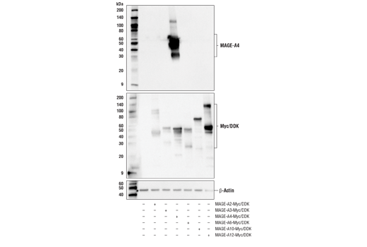 Western Blotting Image 2: MAGE-A4 (E7O1U) XP<sup>®</sup> Rabbit mAb (BSA and Azide Free)