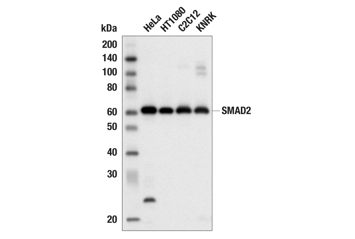 undefined Image 5: PhosphoPlus<sup>®</sup> SMAD2 (Ser465/467) Antibody Duet