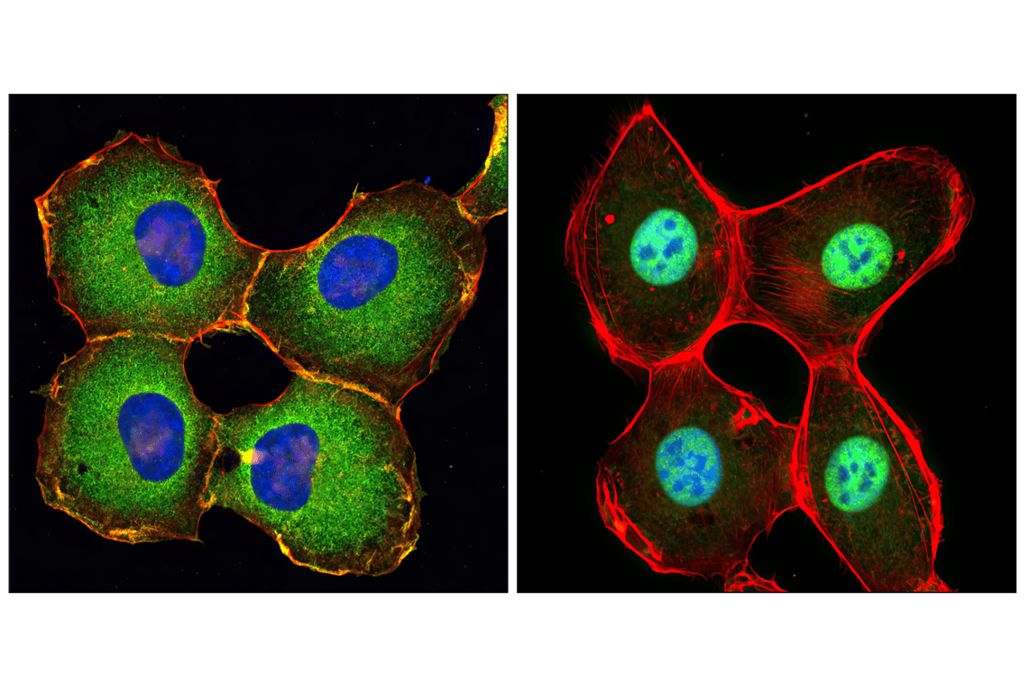 undefined Image 11: PhosphoPlus<sup>®</sup> NF-κB p65/RelA (Ser536) Antibody Duet
