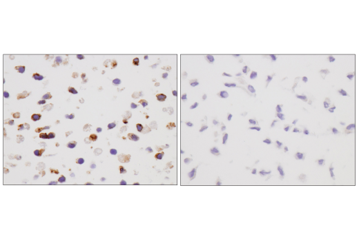 Immunohistochemistry Image 4: VISTA (D5L5T) XP<sup>®</sup> Rabbit mAb (BSA and Azide Free)