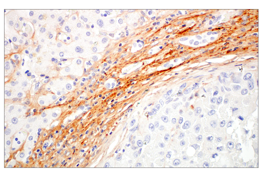 Immunohistochemistry Image 3: COL14A1 (E5W8S) Rabbit mAb (BSA and Azide Free)