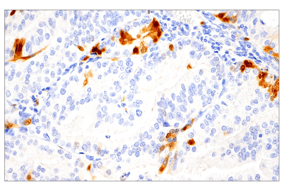 undefined Image 41: Cannabinoid Receptor 1 Downstream Signaling Antibody Sampler Kit