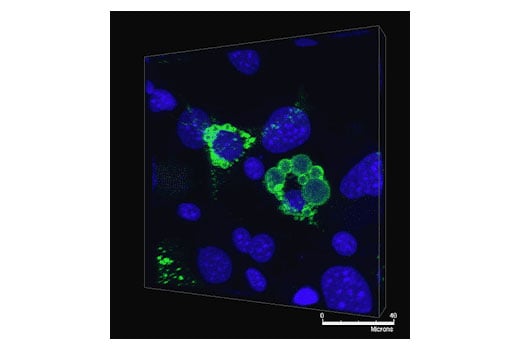 Immunofluorescence Image 1: Perilipin-1 (D1D8) XP<sup>®</sup> Rabbit mAb