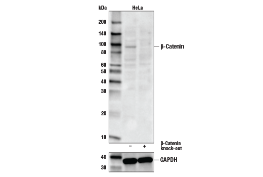 Western Blotting Image 1: Non-phospho (Active) β-Catenin (Ser33/37/Thr41) (D13A1) Rabbit mAb