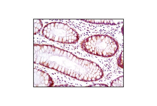 Immunohistochemistry Image 1: MRPL11 (D68F2) XP<sup>®</sup> Rabbit mAb