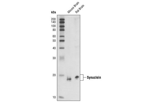 Western Blotting Image 1: α/β-Synuclein (Syn205) Mouse mAb