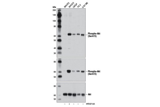 Western Blotting Image 2: Phospho-Akt (Ser473) (D9W9U) Mouse mAb