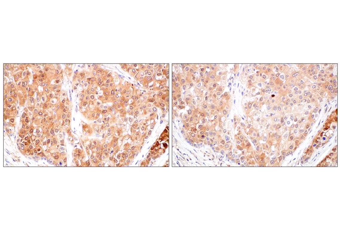 Immunohistochemistry Image 9: SerpinB1 (E4W7B) Rabbit mAb