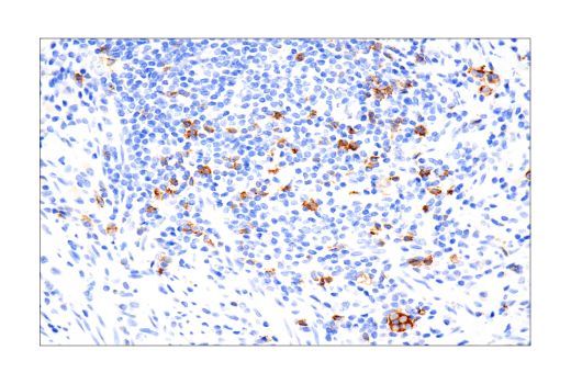 Immunohistochemistry Image 3: B3GAT1 (NK-1) Mouse mAb