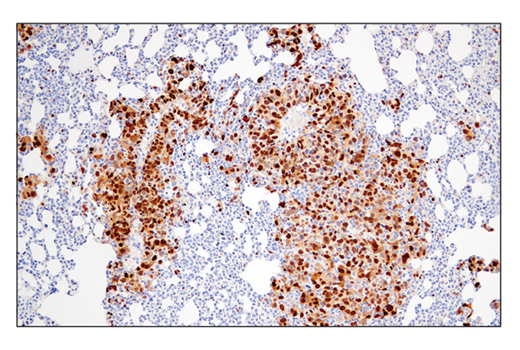 Immunohistochemistry Image 4: Cyclin D1 (E3P5S) XP<sup>®</sup> Rabbit mAb