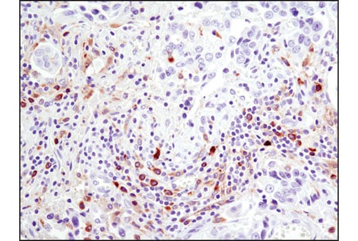 undefined Image 9: PhosphoPlus<sup>®</sup> Btk (Tyr223) Antibody Duet