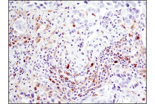 undefined Image 9: PhosphoPlus<sup>®</sup> Btk (Tyr223) Antibody Duet