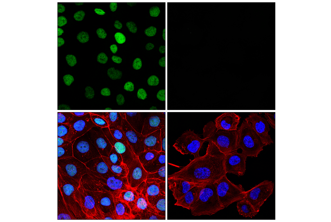 Immunofluorescence Image 1: ELF3 (F8J2G) Rabbit mAb