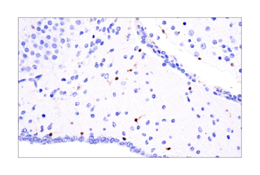 Immunohistochemistry Image 3: ASC/TMS1 (D2W8U) Rabbit mAb