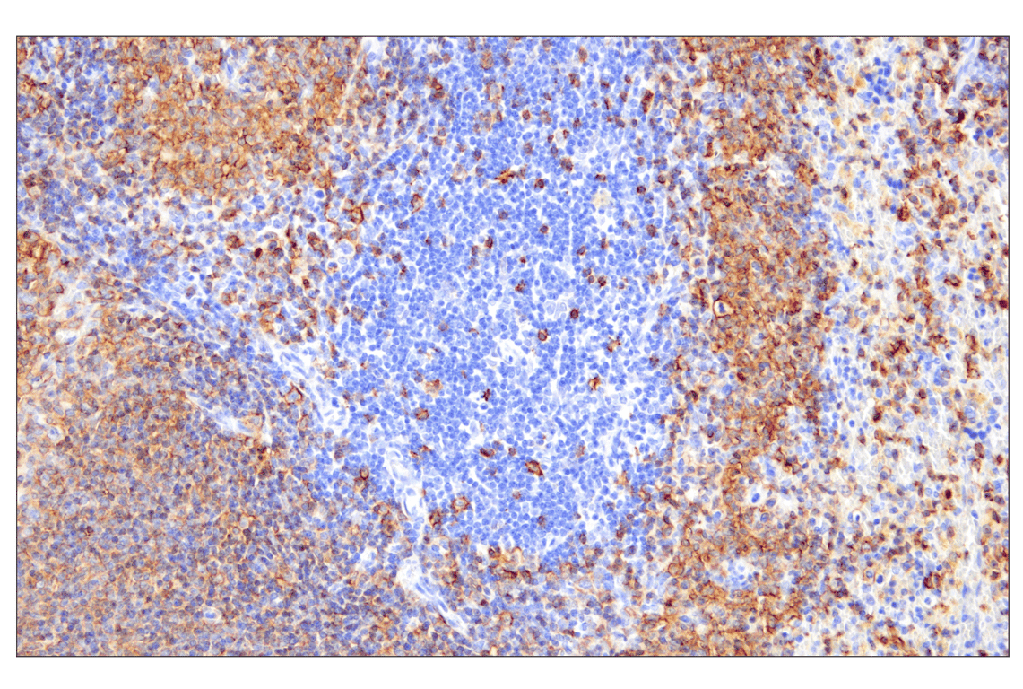 Immunohistochemistry Image 3: CD20 (E3N7O) XP<sup>®</sup> Rabbit mAb