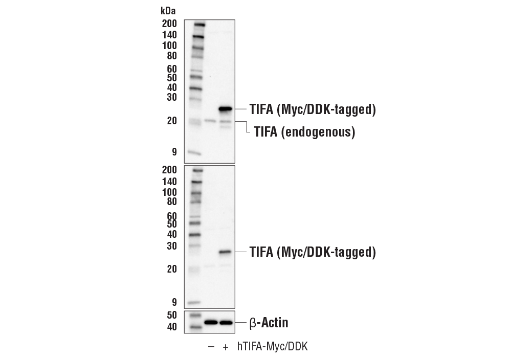 Western Blotting Image 2: TIFA (E9W1L) Rabbit mAb