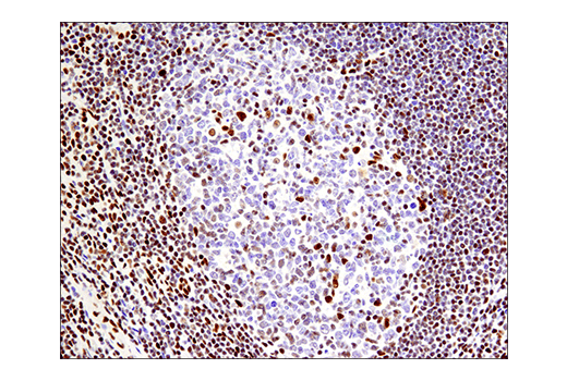 Immunohistochemistry Image 10: Phospho-ATF-2 (Thr71)/ATF-7 (Thr53) (E4A5G) XP<sup>®</sup> Rabbit mAb