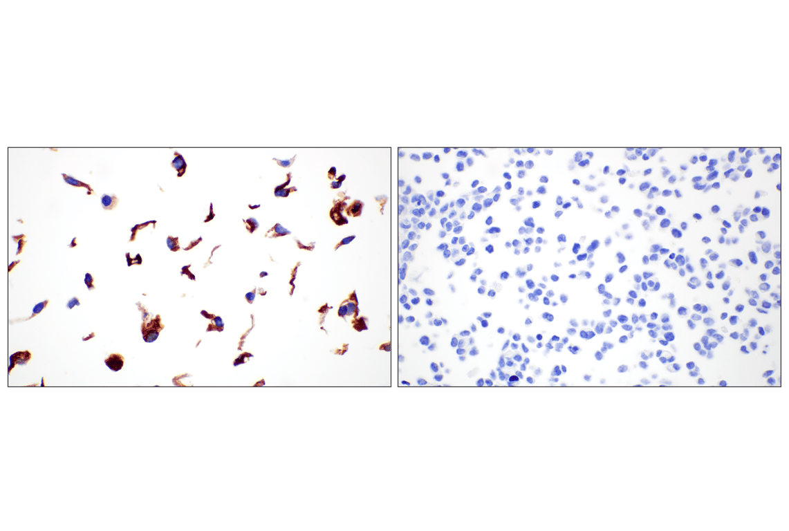 Immunohistochemistry Image 9: COL4A1 (E5M6R) Rabbit mAb (IHC Formulated)