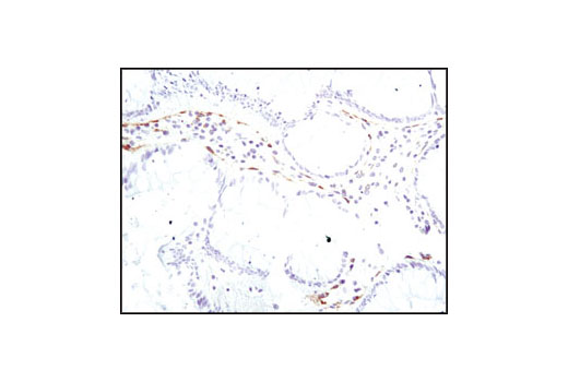 Immunohistochemistry Image 2: PDGF Receptor α (D1E1E) XP<sup>®</sup> Rabbit mAb (BSA and Azide Free)