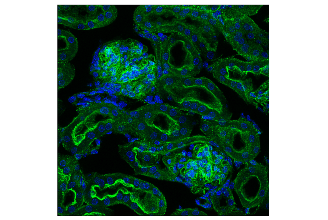 Immunofluorescence Image 4: Numb (C29G11) Rabbit mAb