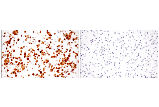 Immunohistochemistry Image 14: IL-18 (E3G8R) Rabbit mAb