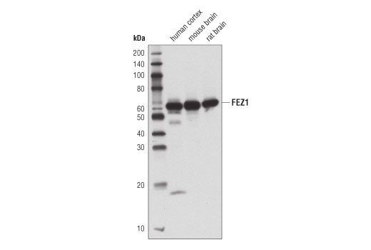 Western Blotting Image 1: FEZ1 (D9R8Q) Rabbit mAb