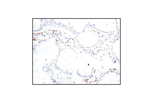 Immunohistochemistry Image 2: PDGF Receptor α (D1E1E) XP<sup>®</sup> Rabbit mAb