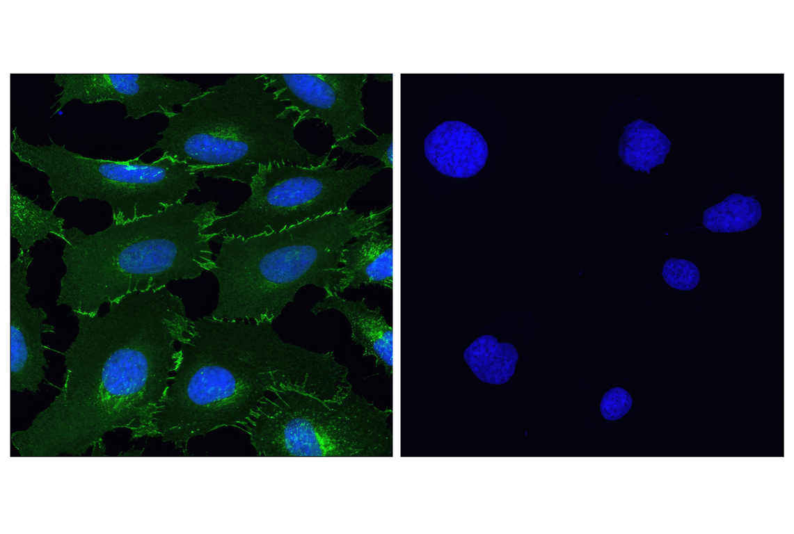 undefined Image 50: Cadherin-Catenin Antibody Sampler Kit