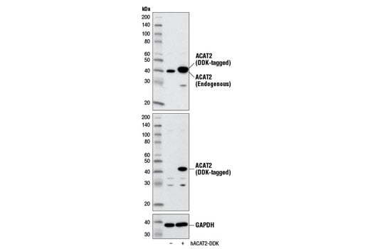 Western Blotting Image 2: ACAT2 (E1L8V) Rabbit mAb