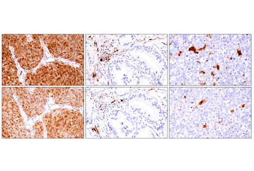 Immunohistochemistry Image 5: S100B (E7C3A) Rabbit mAb