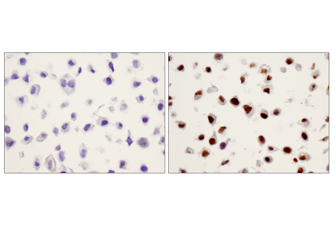 undefined Image 30: Stat3/Stat5 Signaling Antibody Sampler Kit