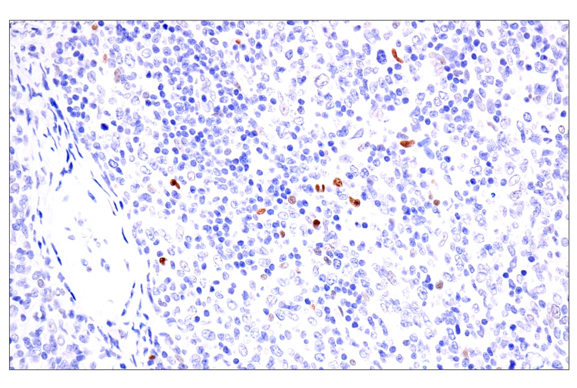 Immunohistochemistry Image 5: BATF3 (E3F3L) Rabbit mAb