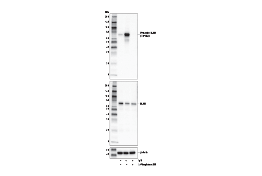 Western Blotting Image 2: Phospho-BLNK (Thr152) (E4P2P) Rabbit mAb