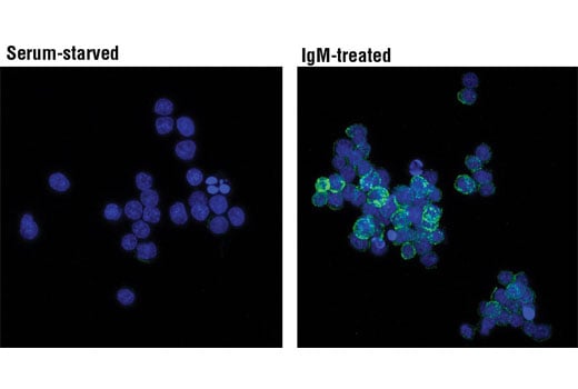 undefined Image 14: B Cell Signaling Antibody Sampler Kit II