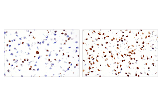 Immunohistochemistry Image 1: Phospho-ATF-2 (Thr71)/ATF-7 (Thr53) (E4A5G) XP<sup>®</sup> Rabbit mAb