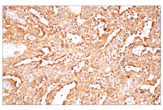 Immunohistochemistry Image 6: CD54/ICAM-1 (E3Q9N) XP<sup>®</sup> Rabbit mAb (BSA and Azide Free)