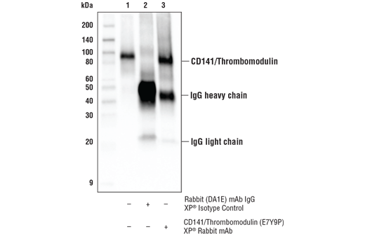 Immunoprecipitation Image 1: CD141/Thrombomodulin (E7Y9P) XP<sup>®</sup> Rabbit mAb