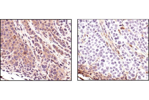 Immunohistochemistry Image 5: Phospho-Akt (Ser473) (736E11) Rabbit mAb