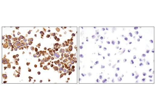 undefined Image 25: Human Exhausted CD8<sup>+</sup> T Cell IHC Antibody Sampler Kit