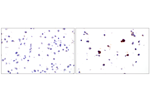undefined Image 39: Extracellular Matrix Dynamics Antibody Sampler Kit