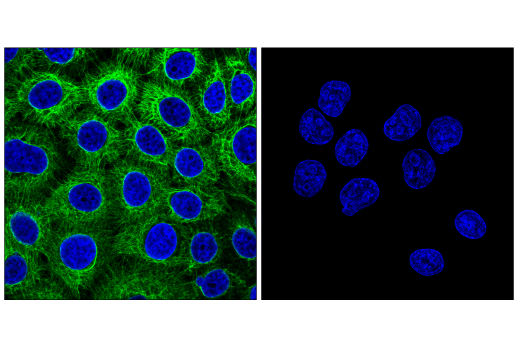 Immunofluorescence Image 1: Keratin 5 (E2T4B) XP<sup>®</sup> Rabbit mAb