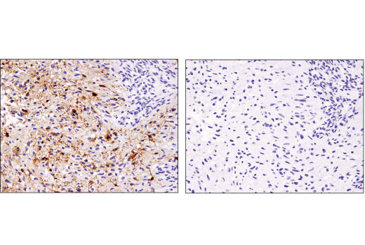 Immunohistochemistry Image 3: EGF Receptor vIII (D6T2Q) XP<sup>®</sup> Rabbit mAb (BSA and Azide Free)