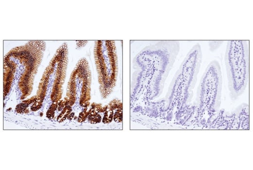 Immunohistochemistry Image 6: EpCAM (E6V8Y) XP<sup>®</sup> Rabbit mAb (BSA and Azide Free)